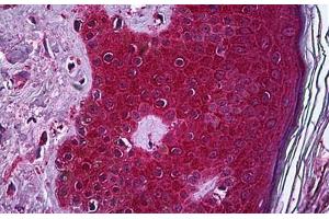 Human Skin: Formalin-Fixed, Paraffin-Embedded (FFPE)