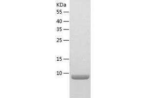 Western Blotting (WB) image for Granulocyte Chemotactic Protein 2 (GCP2) (AA 43-114) protein (His tag) (ABIN7123194) (GCP2 Protein (AA 43-114) (His tag))