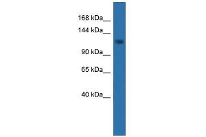 WB Suggested Anti-CDKL5 Antibody Titration: 0. (CDKL5 anticorps  (C-Term))
