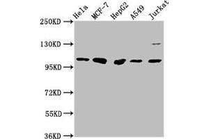 Western Blot Positive WB detected in: Hela whole cell lysate, MCF-7 whole cell lysate, HepG2 whole cell lysate, A549 whole cell lysate, Jurkat whole cell lysate All lanes: GANC antibody at 1:1000 Secondary Goat polyclonal to rabbit IgG at 1/50000 dilution Predicted band size: 105 kDa Observed band size: 105 kDa (GANC anticorps  (AA 171-318))