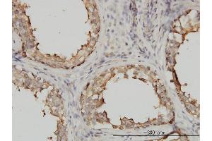 Immunoperoxidase of monoclonal antibody to TUBA1 on formalin-fixed paraffin-embedded human testis.