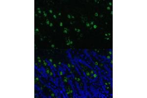 Immunofluorescence analysis of rat colon using CLC Polyclonal Antibody (5041) at dilution of 1:100 (40x lens).