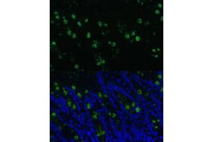 Immunofluorescence analysis of rat colon using CLC Polyclonal Antibody (5041) at dilution of 1:100 (40x lens). (CLCA1 anticorps  (AA 22-150))