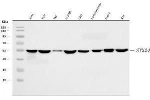 Western blot analysis of MST3/STK24 using anti-MST3/STK24 antibody (ABIN7599389).
