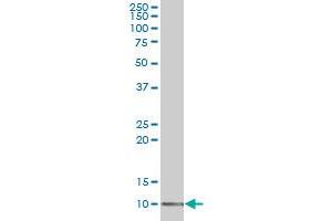 LSM2 polyclonal antibody (A01), Lot # 061130JCS1 Western Blot analysis of LSM2 expression in 293 . (LSM2 anticorps  (AA 1-95))