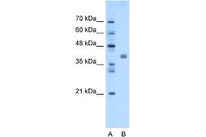 WB Suggested Anti-TMEM59L Antibody Titration: 1. (TMEM59L anticorps  (N-Term))
