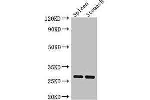 Western Blot Positive WB detected in: Mouse spleen tissue, Mouse stomach tissue All lanes: CTRB1 antibody at 3 μg/mL Secondary Goat polyclonal to rabbit IgG at 1/50000 dilution Predicted band size: 28 kDa Observed band size: 28 kDa (CTRB1 anticorps  (AA 19-263))