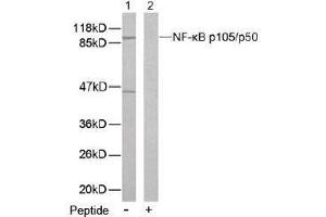 Image no. 2 for anti-Nuclear Factor of kappa Light Polypeptide Gene Enhancer in B-Cells 1 (NFKB1) (Ser893) antibody (ABIN197124) (NFKB1 anticorps  (Ser893))