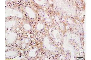 Formalin-fixed and paraffin embedded human kidney labeled with Rabbit Anti-PDGFBB Polyclonal Antibody, Unconjugated  at 1:200 followed by conjugation to the secondary antibody and DAB staining, (PDGF-BB Homodimer (AA 151-241) anticorps)