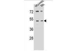 UNQ9391 Antibody (C-term) western blot analysis in NCI-H460,293 cell line lysates (35 µg/lane). (PRSS55 anticorps  (C-Term))