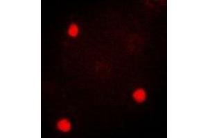 anti-TIA1 Cytotoxic Granule-Associated RNA Binding Protein (TIA1) antibody