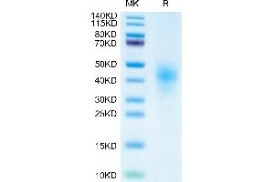 KLRK1 Protein (AA 73-216) (His tag)