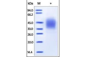 Human Fc gamma RIIIB/CD16b, His Tag on SDS-PAGE under reducing (R) condition.