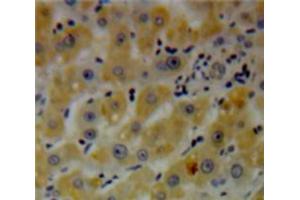 Used in DAB staining on fromalin fixed paraffin-embedded Liver tissue