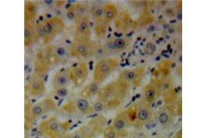 Used in DAB staining on fromalin fixed paraffin-embedded Liver tissue (DGKE anticorps  (AA 243-502))