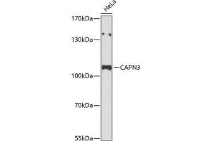Western blot analysis of extracts of HeLa cells, using C Antibody (ABIN6127547, ABIN6137919, ABIN6137921 and ABIN6215925) at 1:3000 dilution. (Calpain 3 anticorps  (AA 1-150))