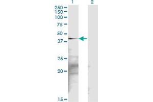 Western Blot analysis of SGK2 expression in transfected 293T cell line by SGK2 monoclonal antibody (M17), clone 2F6. (SGK2 anticorps  (AA 244-344))