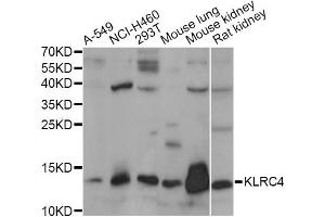 Western blot analysis of extracts of various cell lines, using KLRC4 antibody. (KLRC4 anticorps)