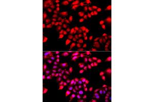 Immunofluorescence analysis of A549 cells using XRCC6 antibody. (XRCC6 anticorps)