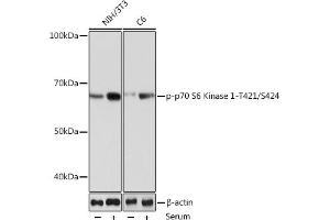 Western blot analysis of extracts of various cell lines, using Phospho-p70 S6 Kinase 1-T421/S424 Rabbit mAb (ABIN6135340, ABIN6136296, ABIN6136297 and ABIN7101878) at 1:1000 dilution.