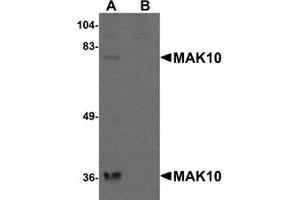 Western Blotting (WB) image for anti-MAK10 Homolog, Amino-Acid N-Acetyltransferase Subunit (MAK10) (N-Term) antibody (ABIN1031448) (MAK10/NAA35 anticorps  (N-Term))