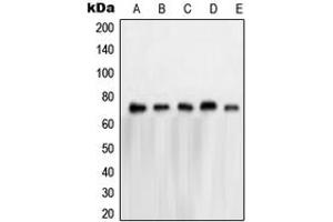 Western blot analysis of NXF1 expression in HeLa (A), A673 (B), K562 (C), Jurkat (D), A431 (E) whole cell lysates. (NXF1 anticorps  (N-Term))