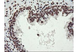 Image no. 11 for anti-F-Box Protein 21 (FBXO21) antibody (ABIN1498233) (FBXO21 anticorps)