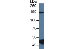 Western Blot; Sample: Porcine Skeletal muscle lysate; Primary Ab: 1. (RBM20 anticorps  (AA 1089-1227))