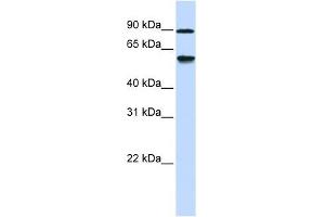 ADHFE1 antibody used at 1 ug/ml to detect target protein. (ADHFE1 anticorps  (Middle Region))