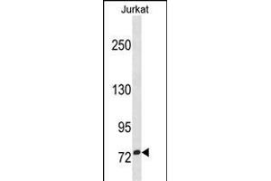 ZN Antibody (N-term) (ABIN1882019 and ABIN2838383) western blot analysis in Jurkat cell line lysates (35 μg/lane). (ZNF274 anticorps  (N-Term))