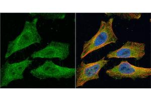 anti-Echinoderm Microtubule Associated Protein Like 1 (EML1) (C-Term) antibody