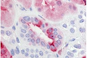 Human Kidney (formalin-fixed, paraffin-embedded) stained with PTGER2 antibody ABIN213471 at 20 ug/ml followed by biotinylated goat anti-rabbit IgG secondary antibody ABIN481713, alkaline phosphatase-streptavidin and chromogen.