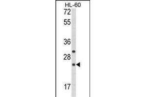 Western blot analysis of RGS1 Antibody (N-term) (ABIN652704 and ABIN2842468) in HL-60 cell line lysates (35 μg/lane). (RGS1 anticorps  (N-Term))
