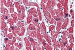 Human Heart: Formalin-Fixed, Paraffin-Embedded (FFPE) (TNNI3 anticorps  (AA 102-211))