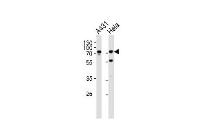 Western blot analysis of lysates from A431, Hela cell line (from left to right), using SEPT9 Antibody at 1:1000 at each lane. (Septin 9 anticorps  (C-Term))