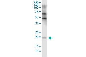 FLJ35767 monoclonal antibody (M03), clone 2F3. (FLJ35767 (AA 1-164) anticorps)