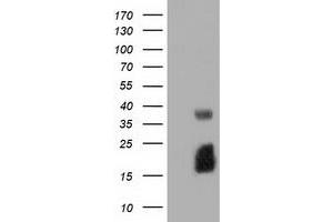Western Blotting (WB) image for anti-Ephrin A2 (EFNA2) antibody (ABIN1497955) (Ephrin A2 anticorps)