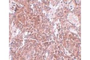 Immunohistochemistry (IHC) image for anti-Tetraspanin 9 (TSPAN9) (Middle Region) antibody (ABIN1031151) (Tetraspanin 9 anticorps  (Middle Region))