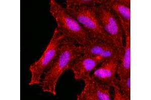 Immunofluorescence of human HeLa cells stained with monoclonal anti-human KCDT15 antibody (1:500) with Texas Red (Red). (KCTD15 anticorps  (AA 1-234))