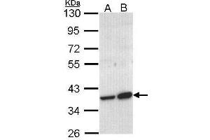 WB Image Sample (30 ug of whole cell lysate) A: Molt-4 , B: Raji 10% SDS PAGE antibody diluted at 1:1000