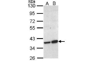 WB Image Sample (30 ug of whole cell lysate) A: Molt-4 , B: Raji 10% SDS PAGE antibody diluted at 1:1000 (ACMSD anticorps)