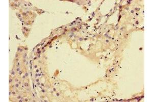 Immunohistochemistry of paraffin-embedded human testis tissue using ABIN7173726 at dilution of 1:100 (TPPP3 anticorps  (AA 2-176))