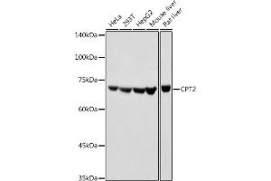Western blot analysis of extracts of various cell lines, using CPT2 antibody (ABIN6129249, ABIN6138983, ABIN6138984 and ABIN6216045) at 1:1000 dilution. (CPT2 anticorps  (AA 1-180))