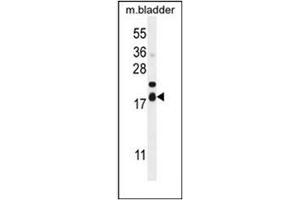 anti-Family with Sequence Similarity 162, Member A (FAM162A) (AA 118-146), (C-Term) antibody