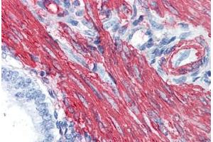 Human Uterus: Formalin-Fixed, Paraffin-Embedded (FFPE)