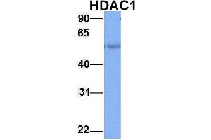 Host:  Rabbit  Target Name:  HDAC1  Sample Type:  Human Adult Placenta  Antibody Dilution:  1.