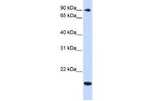 Western Blotting (WB) image for anti-TSR1, 20S rRNA Accumulation, Homolog (TSR1) antibody (ABIN2459005) (TSR1 anticorps)