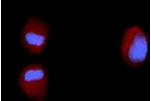 Immunofluorescence (IF) image for anti-Fibroblast Growth Factor 2 (Basic) (FGF2) (AA 143-288) antibody (PE) (ABIN5565476) (FGF2 anticorps  (AA 143-288) (PE))