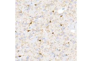 Immunohistochemistry of paraffin-embedded Mouse brain using /IB antibody (ABIN7265554) at dilution of 1:100 (40x lens). (Iba1 anticorps)