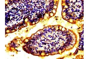 IHC image of ABIN7175871 diluted at 1:100 and staining in paraffin-embedded human small intestine tissue performed on a Leica BondTM system.